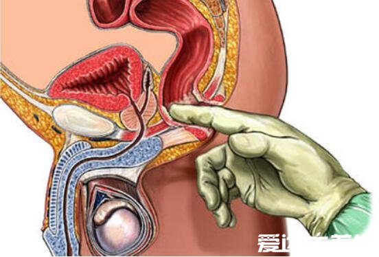 自己按摩前列腺十種手法圖解，每天堅(jiān)持按摩輕松緩解前列腺疾病