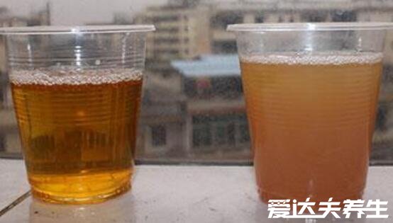 100%準(zhǔn)確測(cè)試男孩女孩的方法，尿尿的顏色竟然是關(guān)鍵