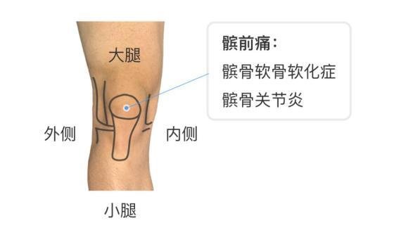 膝蓋各個部位疼痛圖解，膝蓋兩側(cè)疼痛最嚴重須及時就醫(yī)