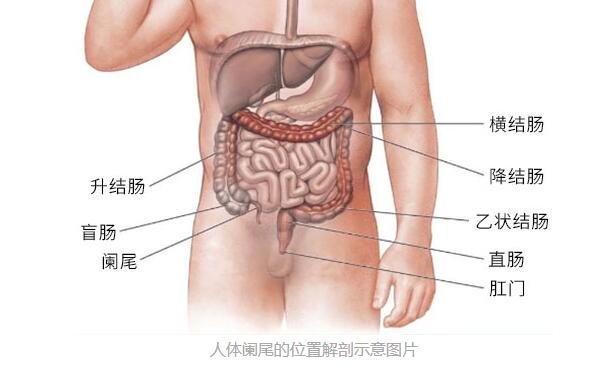 闌尾炎是哪個部位疼，闌尾炎的疼痛位置圖片