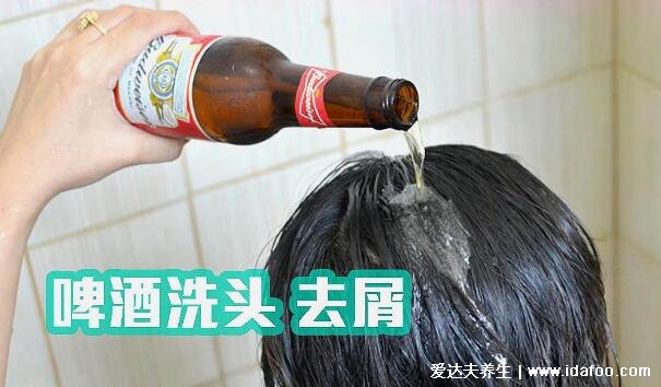 用啤酒洗頭好嗎有什么好處，去屑止癢/柔順發(fā)質(zhì)/防脫發(fā)(附步驟)