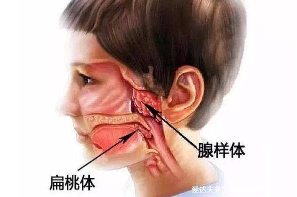 切除腺樣體后悔到家了，別急著手術(shù)影響孩子的發(fā)育和免疫力