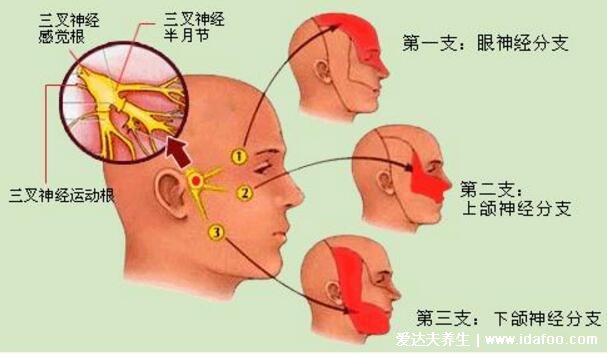 十二級疼痛排行榜牙疼僅排第五，三叉神經(jīng)痛又稱天下第一痛