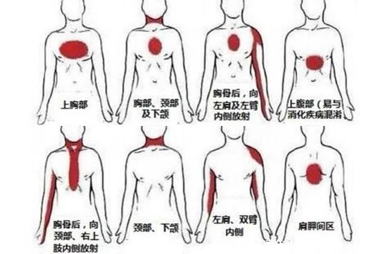 左后背疼圖片位置示意圖，可能是心臟出了問題