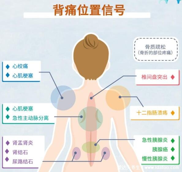 后背疼痛圖片位置示意圖及病情對(duì)照?qǐng)D，警惕后背偏下的消化系統(tǒng)疾病