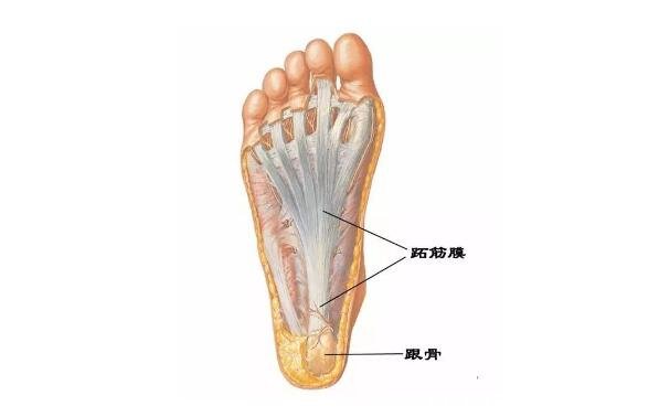 女性足底筋膜炎4個(gè)痛點(diǎn)圖片，跟骨內(nèi)上方最嚴(yán)重(3種止疼方法)