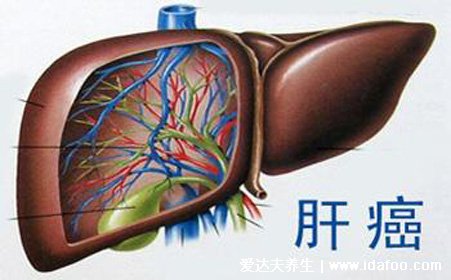 最難治的腫瘤排名，胰腺癌是癌癥之王