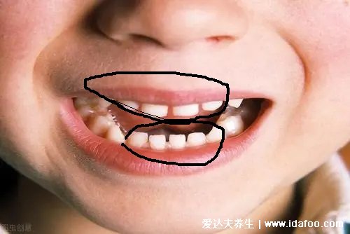 寶寶長(zhǎng)牙順序圖片真圖，先長(zhǎng)門(mén)牙再往旁邊長(zhǎng)