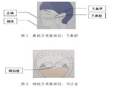 為什么要做鼻拭子不做咽拭子，鼻拭子準(zhǔn)確率更高(都能有效檢測(cè))