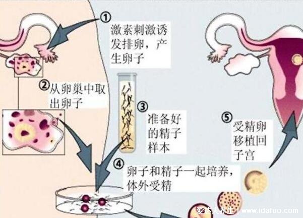 試管嬰兒費用大概要多少錢一次，3-15萬不等/三代試管成功率最高