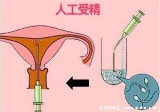 人工授精和試管嬰兒的區(qū)別，試管嬰兒成功率更高有50%