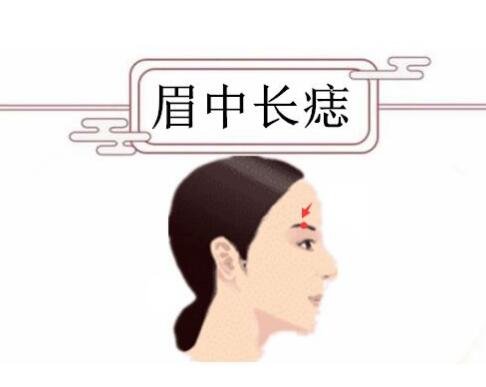 女人身上的10大福痣少見(jiàn)的極富貴痣，屁股有痣財(cái)運(yùn)事業(yè)佳