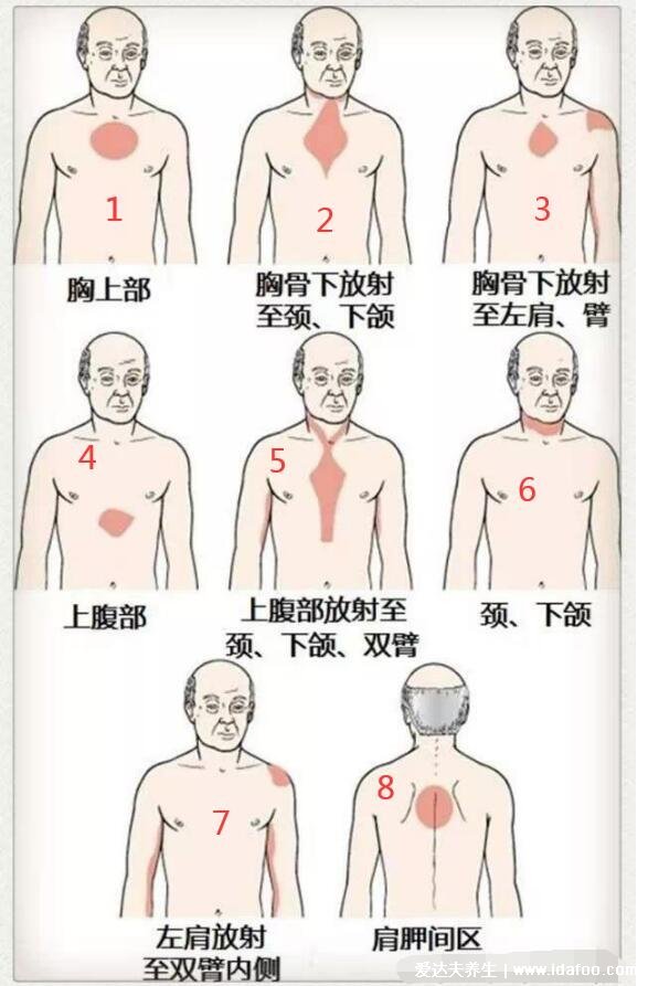 人體器官后背疼痛對(duì)應(yīng)器官圖，9處致命的心臟疼痛位置圖