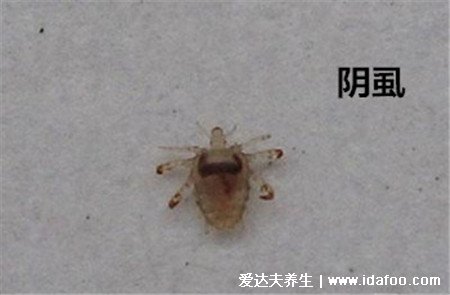 陰虱最怕什么，女性陰虱蟲子圖片(怕碘酒/硫磺皂/陽光)