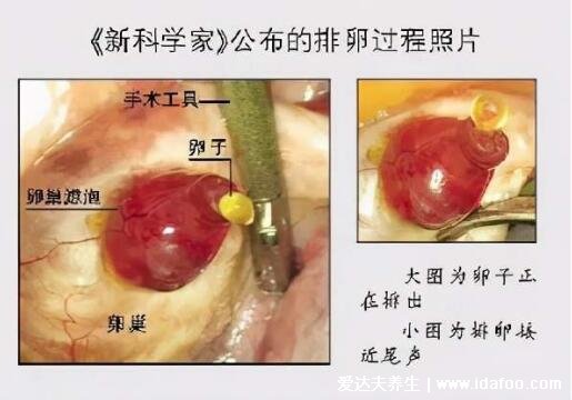 卵子是什么樣的圖片，直徑1.8-2.5cm球形細(xì)胞(卵巢不排卵可不孕)