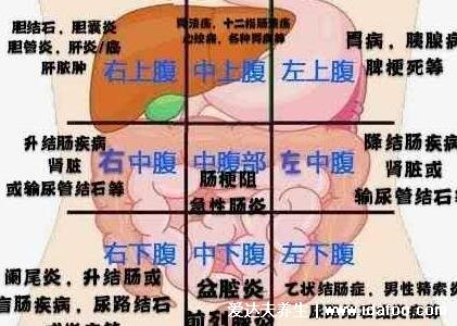 闌尾炎是哪個(gè)部位疼位置示意圖片，右下腹按壓痛(早期上腹肚臍疼)