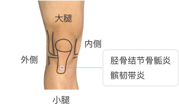 膝蓋疼痛是怎么回事?膝蓋各個(gè)部位疼痛圖解(兩側(cè)疼最嚴(yán)重)