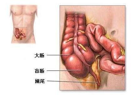 女性闌尾炎的疼痛位置圖片，會(huì)轉(zhuǎn)移性右下腹按壓痛(剛開始上腹肚臍疼)