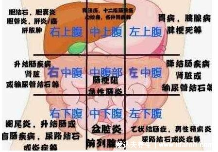 闌尾在哪個位置？闌尾炎是哪個部位疼圖片，注意可轉移右下腹疼痛