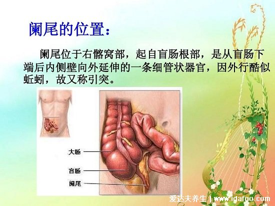 闌尾在哪個位置？闌尾炎是哪個部位疼圖片，注意可轉移右下腹疼痛