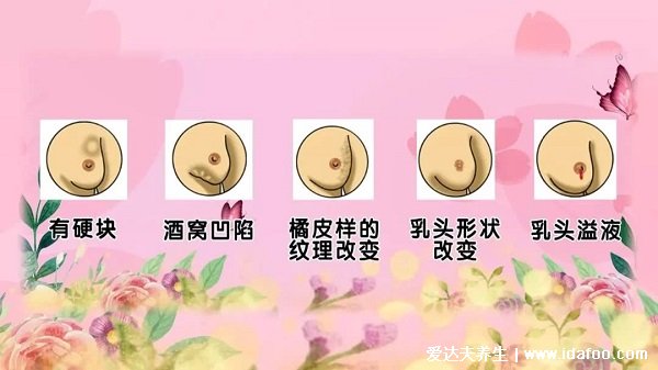 女性乳腺癌圖片早期癥狀，乳頭表面出現(xiàn)溢液要注意(乳房腫塊4大癥狀)