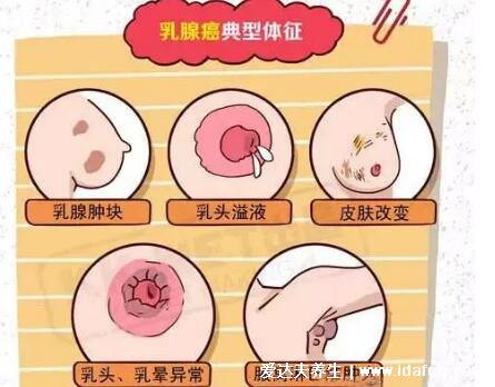 乳房癌癥的早期信號(hào)圖片，乳房腫塊早期可不疼痛(乳頭溢液顏色要注意)