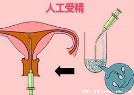 人工助孕方法有哪些，3種方法幫你順利懷上小寶寶