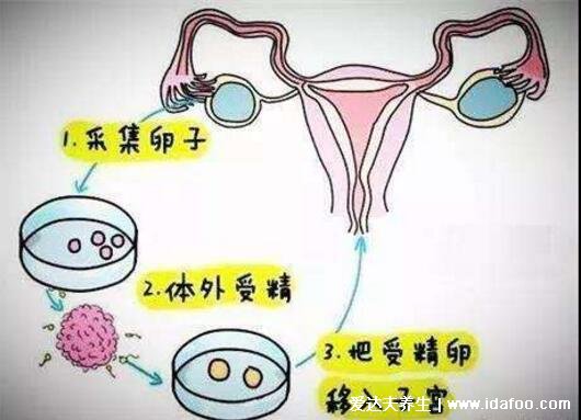 人工授精的過程與費用，3-8千元一個周期成功率50%左右