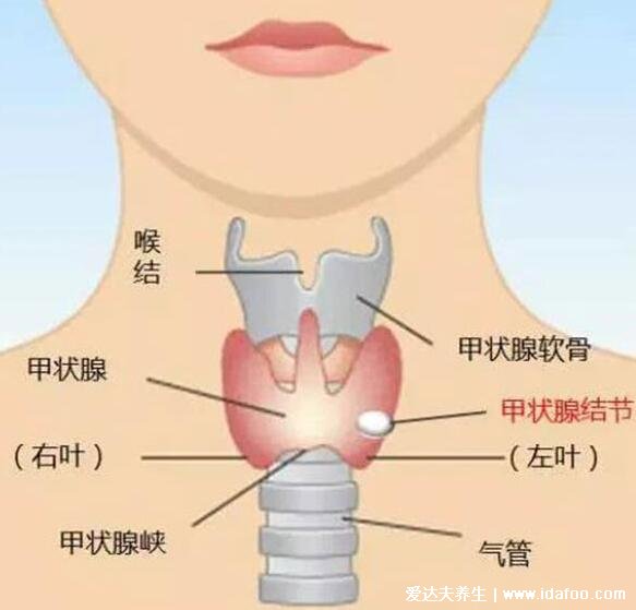 甲狀腺位置圖高清示意圖，警惕脖子異常變粗有凸起腫塊的情況