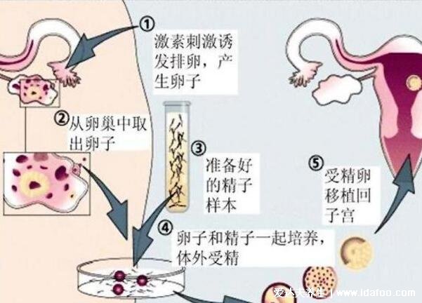 人工授精的過程與費(fèi)用，檢查費(fèi)用開始算起3000到5000元(附過程圖)