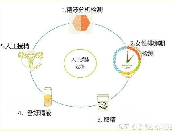 人工授精的過程與費(fèi)用，檢查費(fèi)用開始算起3000到5000元(附過程圖)