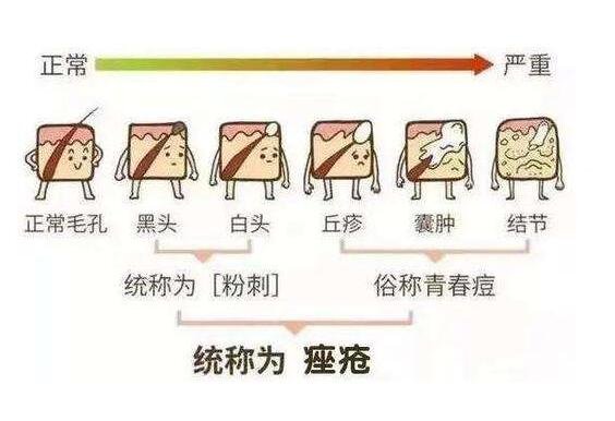 閉口是什么長(zhǎng)什么樣子圖片，額頭鼻翼兩側(cè)的突起白頭(多發(fā)油性皮膚)