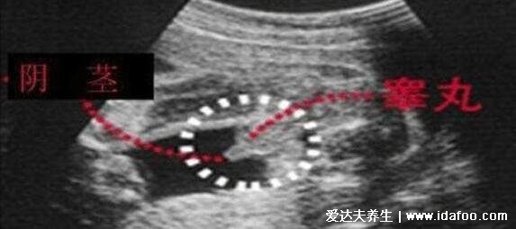 虎年2022生男生女表清宮圖，一分鐘算出寶寶性別超簡單