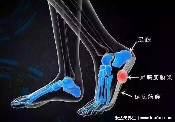 腳底按摩圖反射區(qū)圖片，按摩大腦反射區(qū)可治療頭痛