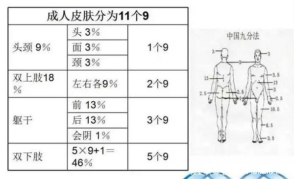 燒傷面積口訣三三三五六七，步步解析數(shù)字詳細(xì)意思(頭面頸3%) 