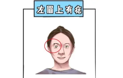 女人痣相圖解臉上，眉毛有痣是富貴命(有些痣必須點(diǎn)掉)