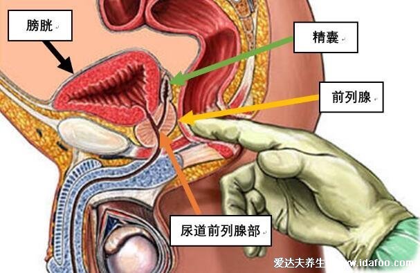 如何判斷自己前列腺炎，50%的男性會患病可對比癥狀自測 