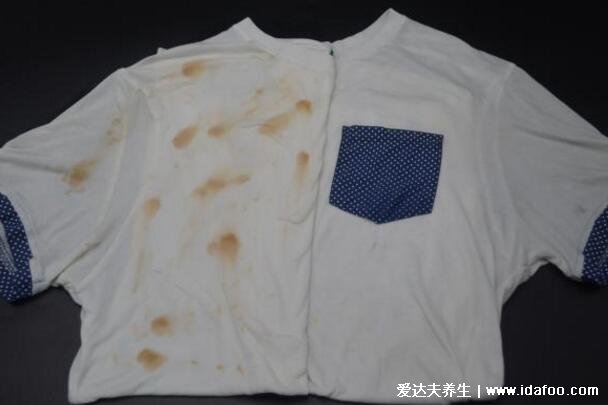 白衣服發(fā)黃怎么洗可以變白，妙用84消毒液/小蘇打/白醋輕松復(fù)原