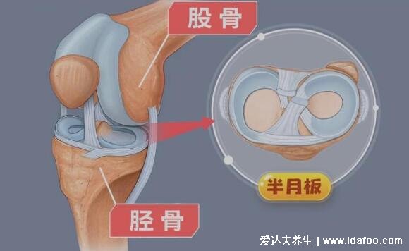 半月板是什么部位圖片，位于膝關節(jié)的內外兩側起緩沖作用