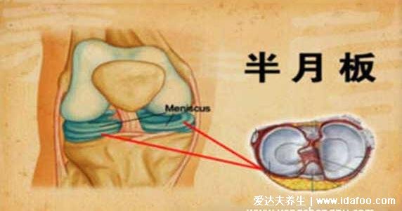 半月板是什么部位圖片，位于膝關節(jié)的內外兩側起緩沖作用