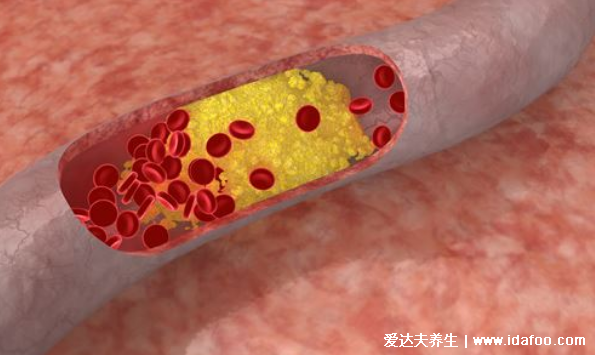 你還在減肥？體重低當心 5種病找上門