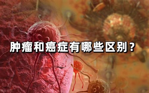 腫瘤不一定就是癌癥2個(gè)方面區(qū)分腫瘤和癌癥