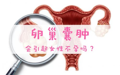 卵巢囊腫會引起女性不孕嗎該如何治療及預(yù)防