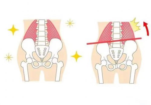 睡前4個(gè)動作有效幫助骨盆回正